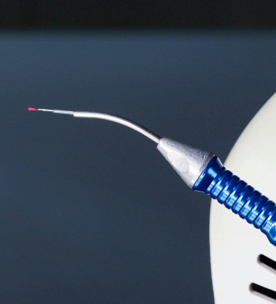 A close-up of a specialized LANAP dental laser handpiece with a thin fiber-optic tip emitting a concentrated red laser light.