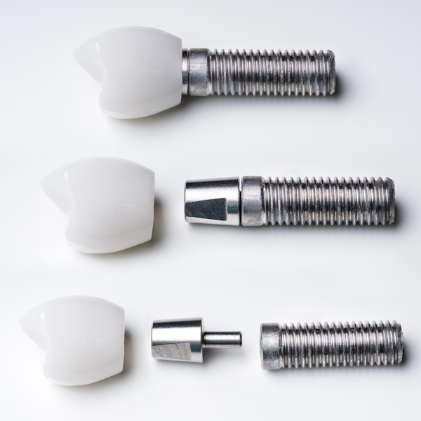 A deconstructed view of a dental implant assembly on a white background, showing the three main components: the titanium implant post, the abutment, and the ceramic tooth crown.